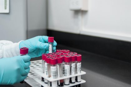 Profissional de laboratório usando luvas ao manipular tubos de ensaio durante um procedimento de análise.